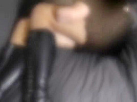 Arm Amputee
