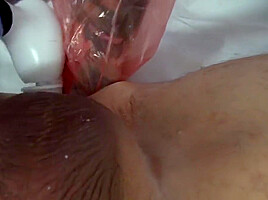 Huge massive speculum and fisting by Lady Jane Van Dark,fist
