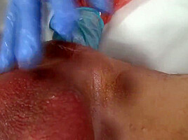 Huge massive speculum and fisting by Lady Jane Van Dark,fist