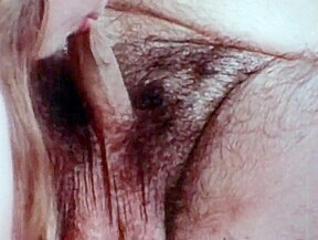 I Felta Thigh