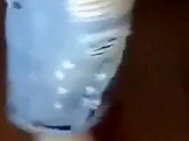 Long Toenails 2