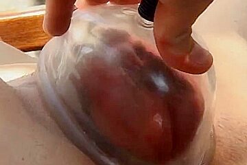 Vagina Pumping
