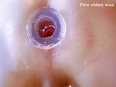 Watching My Inside By Butthole Plug